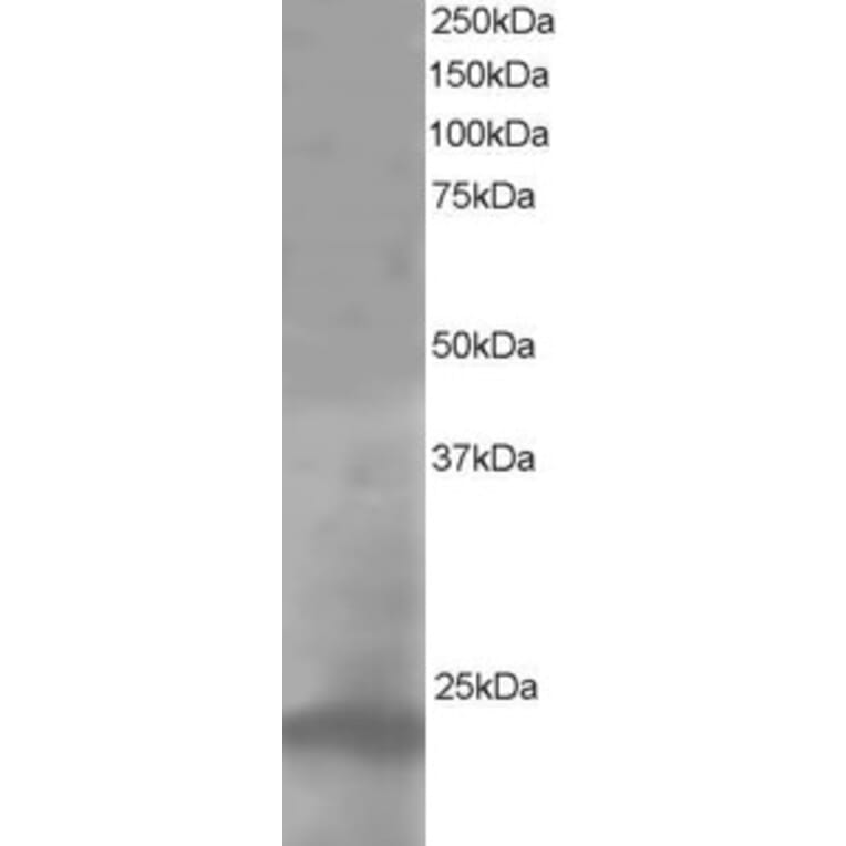 Western Blot - Anti-Pallidin Antibody (A83927) - Antibodies.com