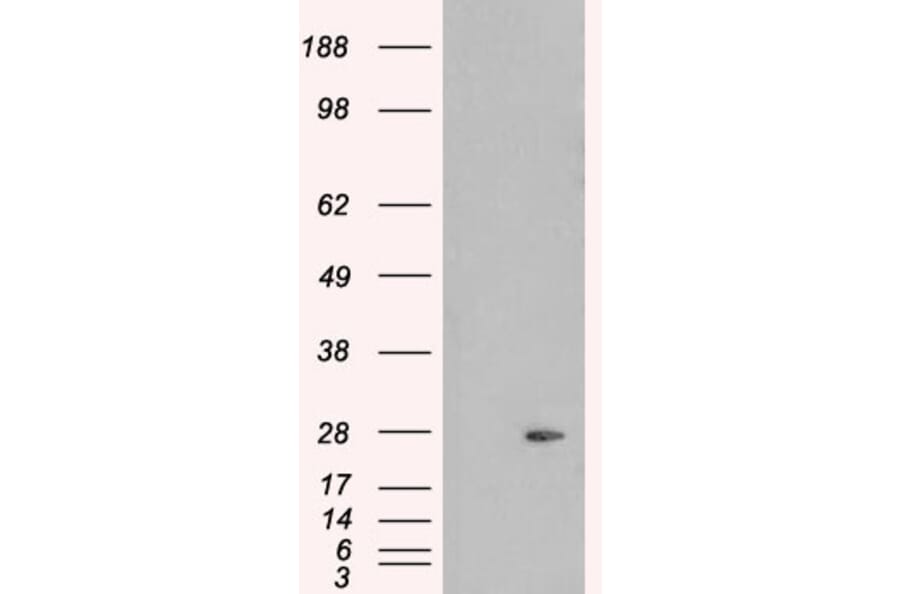 Western Blot - Anti-Pallidin Antibody (A83927) - Antibodies.com