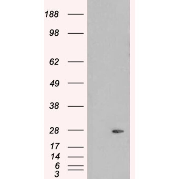 Western Blot - Anti-Pallidin Antibody (A83927) - Antibodies.com