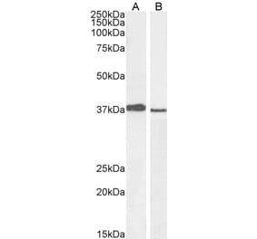 Western Blot - Anti-Mel18 Antibody (A83930) - Antibodies.com