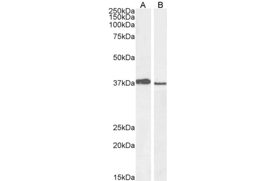 Western Blot - Anti-Mel18 Antibody (A83930) - Antibodies.com