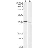 Western Blot - Anti-Mel18 Antibody (A83930) - Antibodies.com