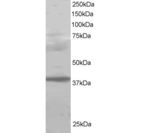 Western Blot - Anti-PCGF2 Antibody (A83930) - Antibodies.com