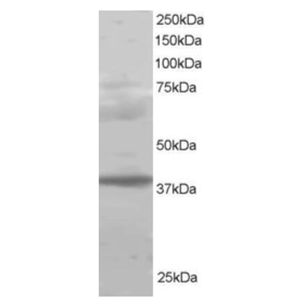 Western Blot - Anti-PCGF2 Antibody (A83930) - Antibodies.com