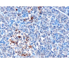 Immunohistochemistry - Anti-MDA5 Antibody (A83931) - Antibodies.com