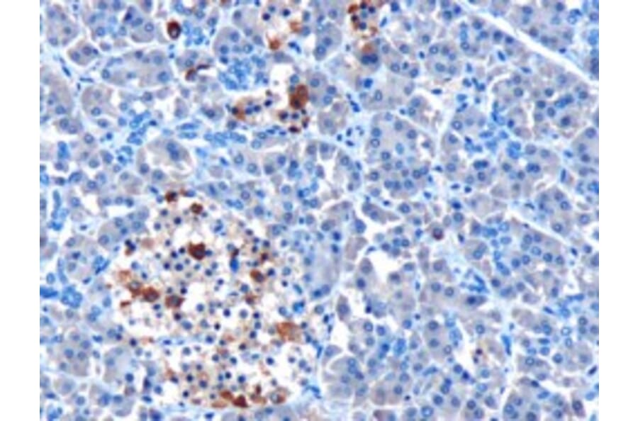 Immunohistochemistry - Anti-MDA5 Antibody (A83931) - Antibodies.com