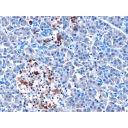 Immunohistochemistry - Anti-IFIH1 Antibody (A83931) - Antibodies.com