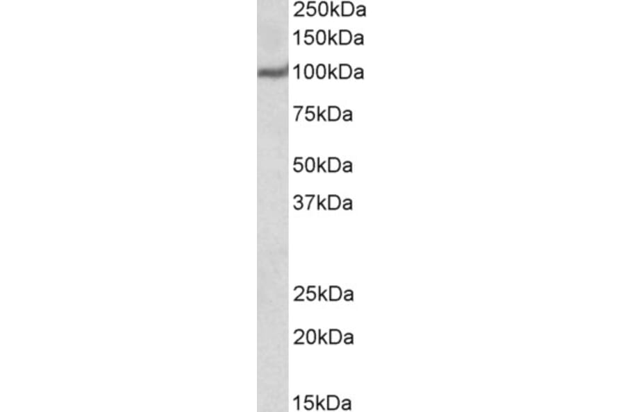 Western Blot - Anti-USP4 Antibody (A83932) - Antibodies.com