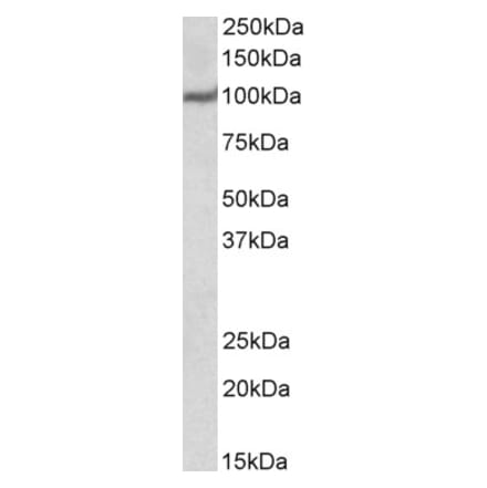 Western Blot - Anti-USP4 Antibody (A83932) - Antibodies.com