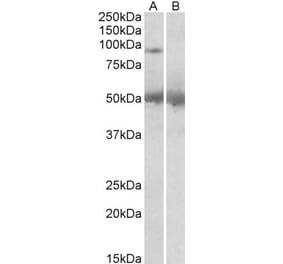 Western Blot - Anti-USP6 Antibody (A83933) - Antibodies.com