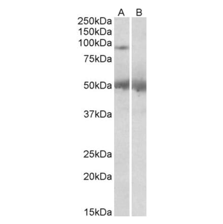 Western Blot - Anti-USP6 Antibody (A83933) - Antibodies.com