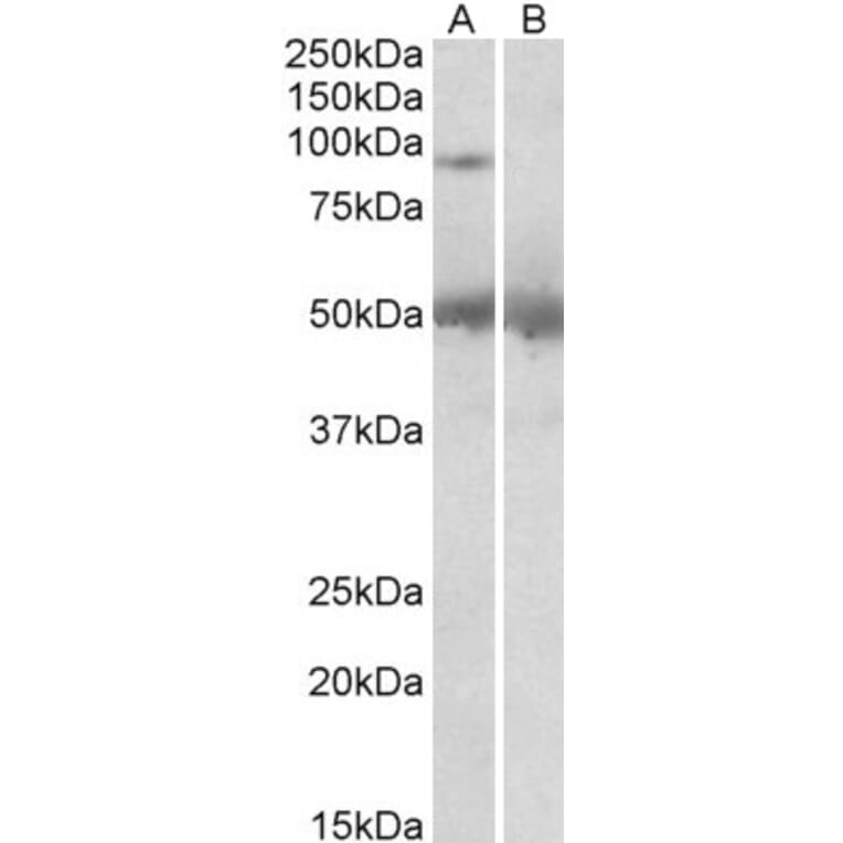 Western Blot - Anti-USP6 Antibody (A83933) - Antibodies.com