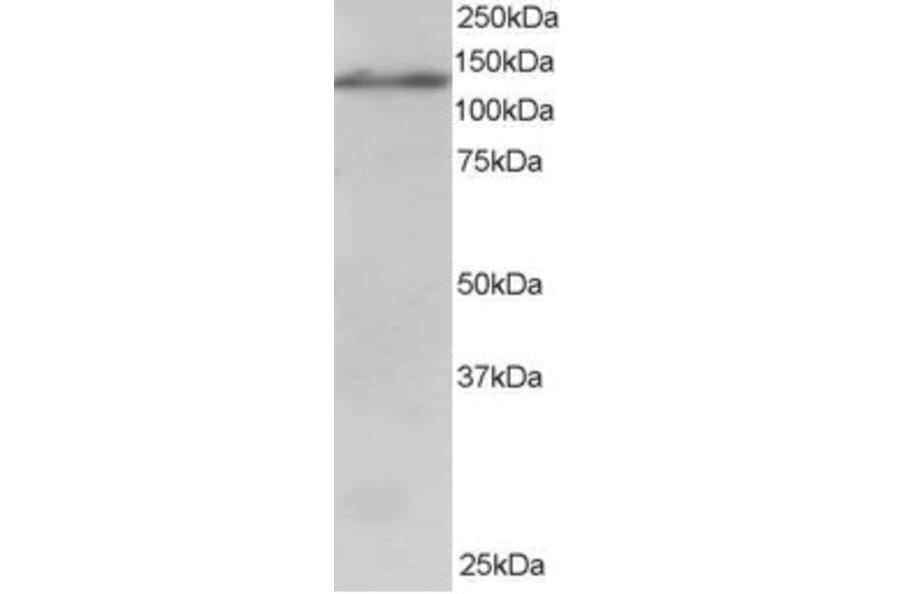Western Blot - Anti-USP11 Antibody (A83934) - Antibodies.com