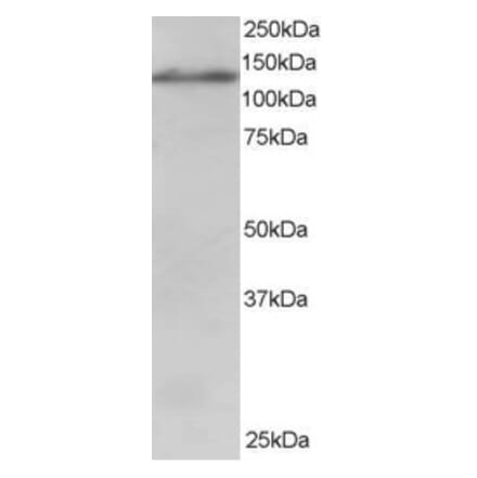 Western Blot - Anti-USP11 Antibody (A83934) - Antibodies.com