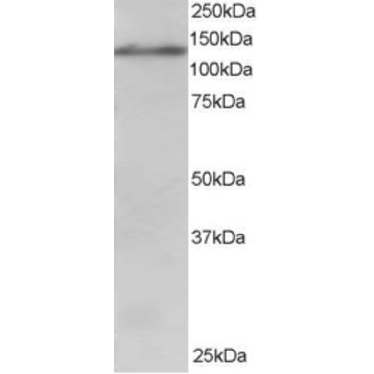 Western Blot - Anti-USP11 Antibody (A83934) - Antibodies.com
