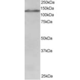 Western Blot - Anti-USP11 Antibody (A83934) - Antibodies.com