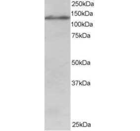 Western Blot - Anti-USP11 Antibody (A83934) - Antibodies.com