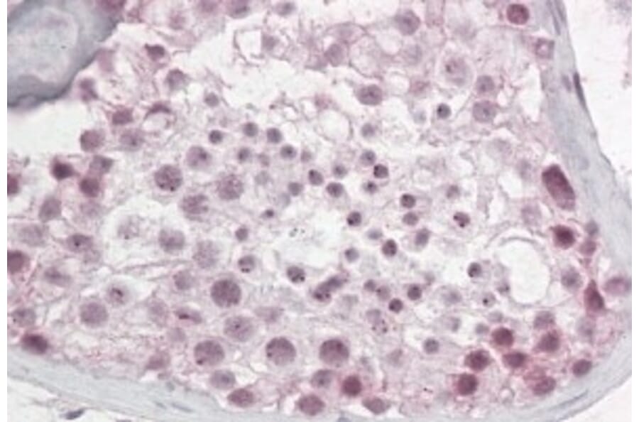 Immunohistochemistry - Anti-Pescadillo Antibody (A83936) - Antibodies.com