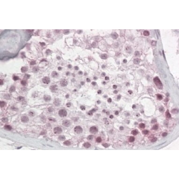 Immunohistochemistry - Anti-Pescadillo Antibody (A83936) - Antibodies.com