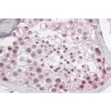 Immunohistochemistry - Anti-Pescadillo Antibody (A83936) - Antibodies.com