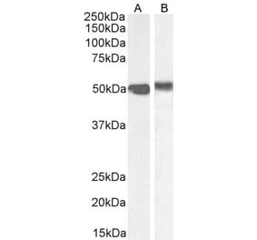 Western Blot - Anti-FOXA1 Antibody (A83938) - Antibodies.com