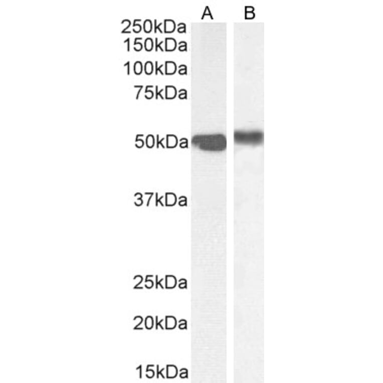 Western Blot - Anti-FOXA1 Antibody (A83938) - Antibodies.com