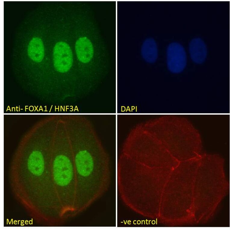 Immunofluorescence - Anti-FOXA1 Antibody (A83938) - Antibodies.com