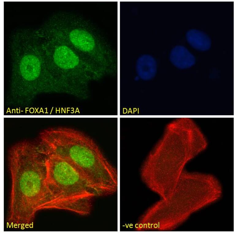 Immunofluorescence - Anti-FOXA1 Antibody (A83938) - Antibodies.com
