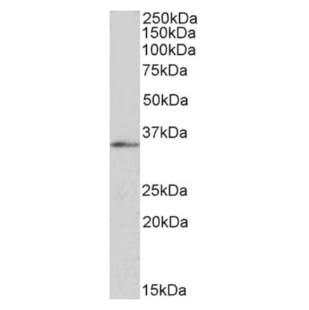Western Blot - Anti-FOXB1 Antibody (A83939) - Antibodies.com