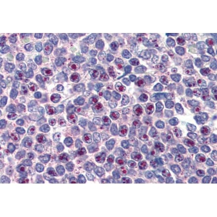 Immunohistochemistry - Anti-FOXC1 Antibody (A83940)