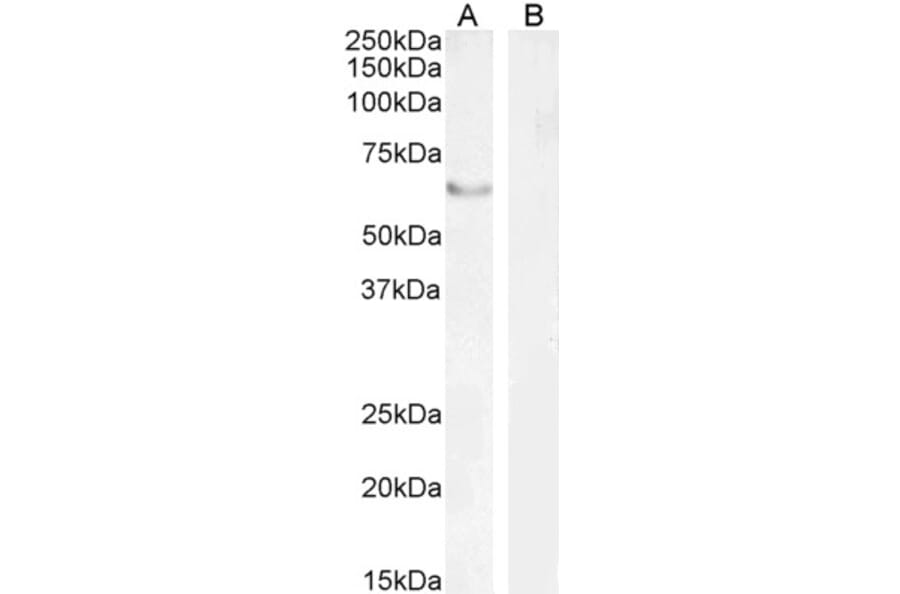 Western Blot - Anti-FOXC2 Antibody (A83941) - Antibodies.com