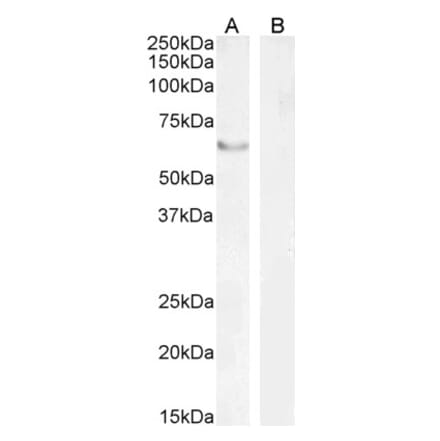 Western Blot - Anti-FOXC2 Antibody (A83941) - Antibodies.com