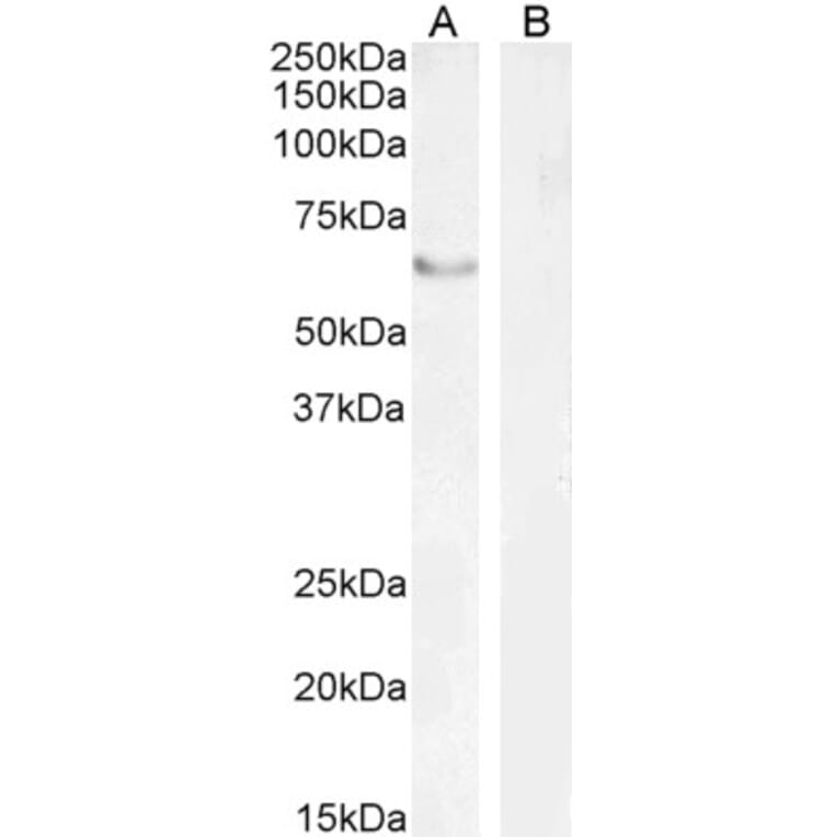 Western Blot - Anti-FOXC2 Antibody (A83941) - Antibodies.com