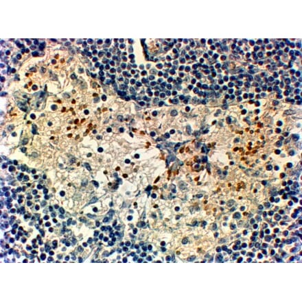 Immunohistochemistry - Anti-FOXC2 Antibody (A83941) - Antibodies.com