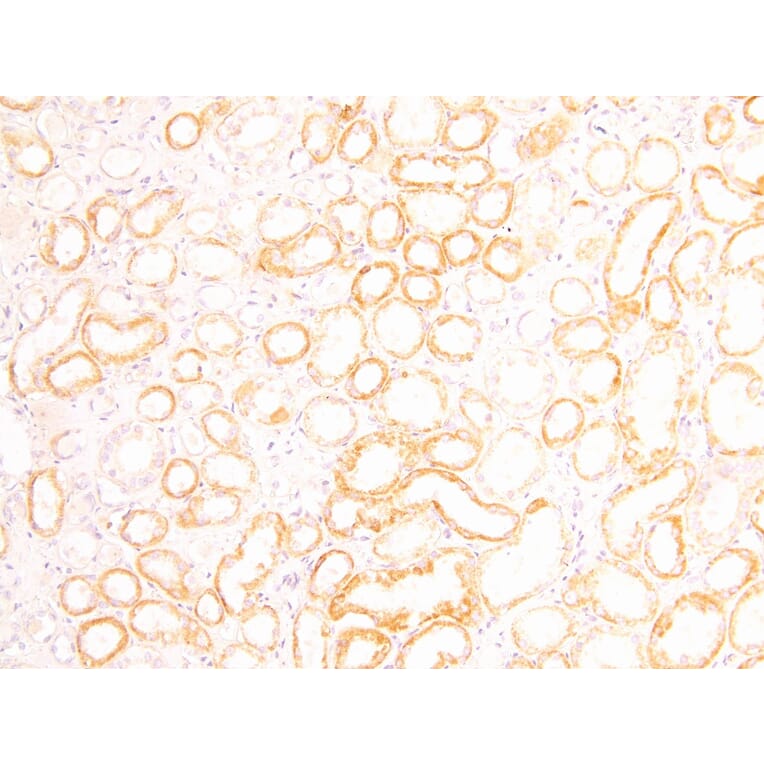 Immunohistochemistry - Anti-FOXD1/BF-2 Antibody (A83942) - Antibodies.com