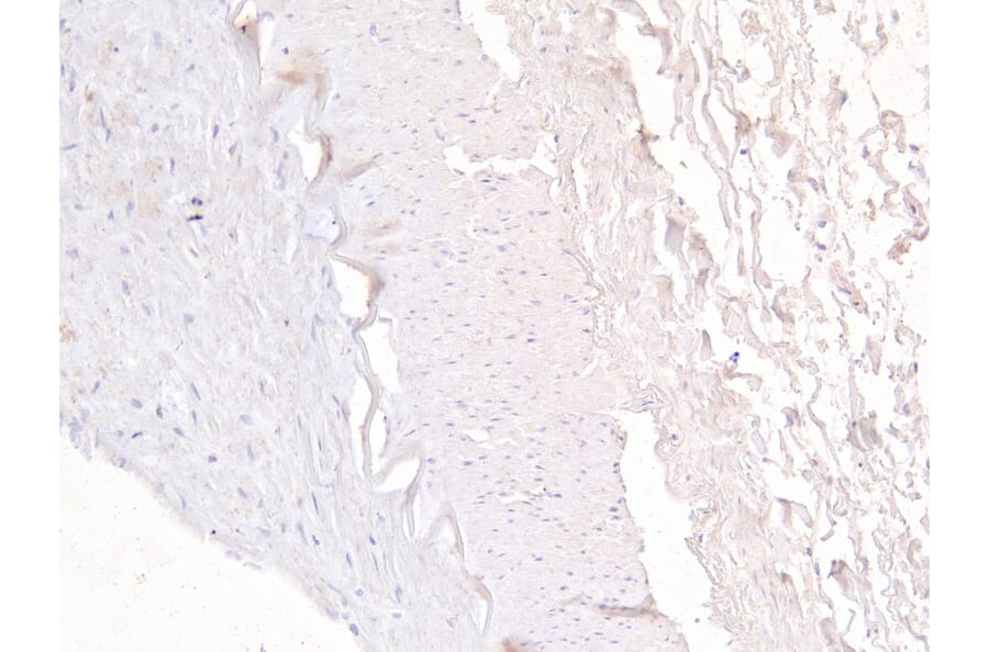 Immunohistochemistry - Anti-FOXD1/BF-2 Antibody (A83942) - Antibodies.com