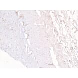 Immunohistochemistry - Anti-FOXD1/BF-2 Antibody (A83942) - Antibodies.com