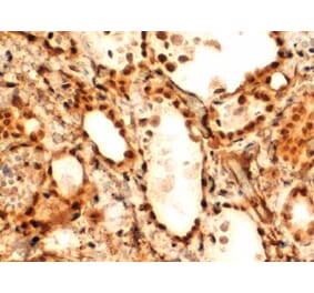 Immunohistochemistry - Anti-TTF2 Antibody (A83943) - Antibodies.com