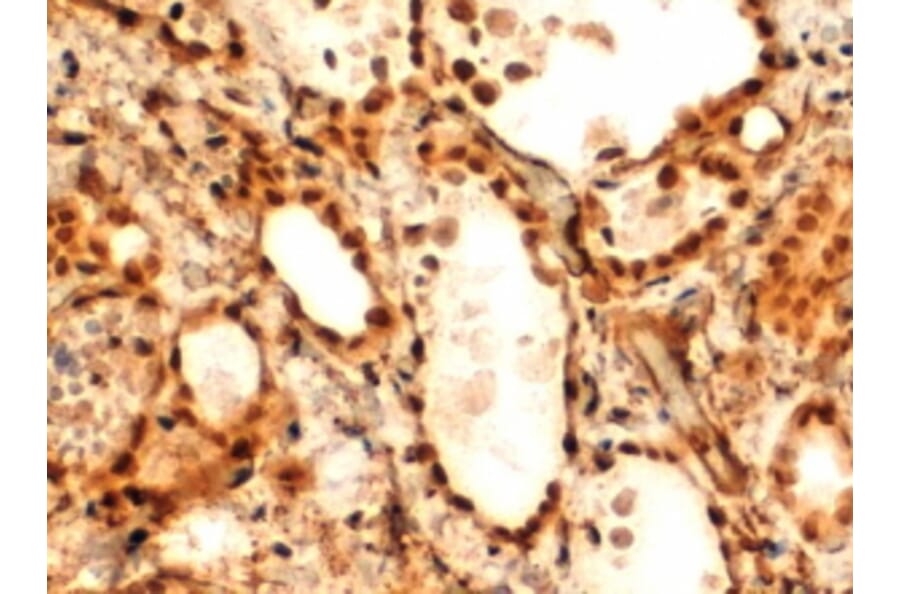 Immunohistochemistry - Anti-TTF2 Antibody (A83943) - Antibodies.com