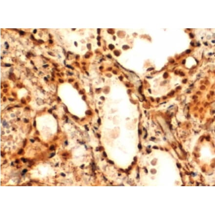 Immunohistochemistry - Anti-TTF2 Antibody (A83943) - Antibodies.com