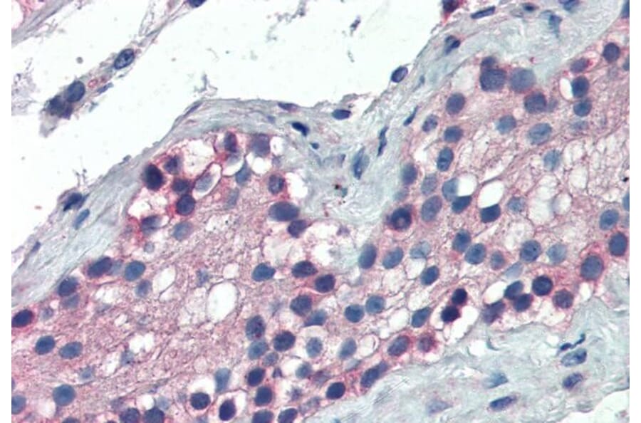 Immunohistochemistry - Anti-TTF2 Antibody (A83943) - Antibodies.com