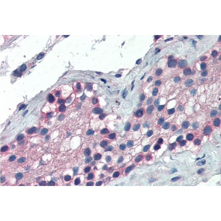 Immunohistochemistry - Anti-TTF2 Antibody (A83943) - Antibodies.com