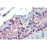 Immunohistochemistry - Anti-TTF2 Antibody (A83943) - Antibodies.com