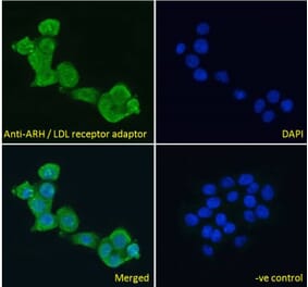 Immunofluorescence - Anti-LDLRAP1 Antibody (A83944) - Antibodies.com