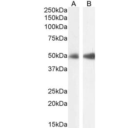 Western Blot - Anti-FOXL2 Antibody (A83945) - Antibodies.com