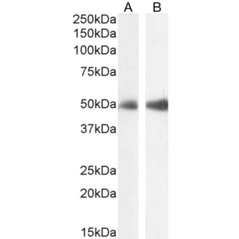Western Blot - Anti-FOXL2 Antibody (A83945) - Antibodies.com