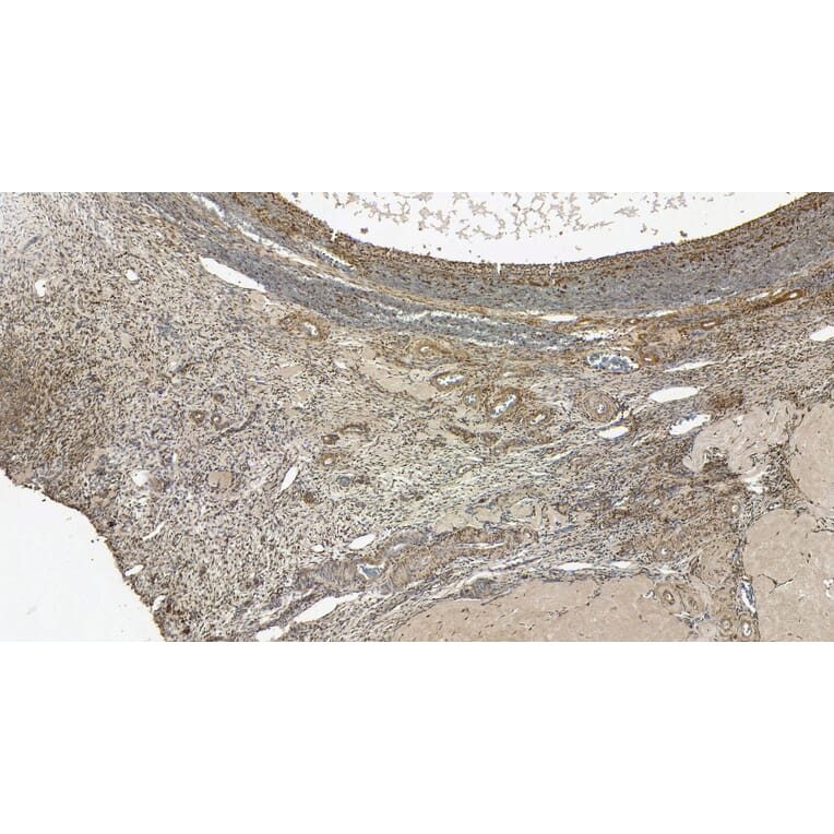 Immunohistochemistry - Anti-FOXL2 Antibody (A83945) - Antibodies.com