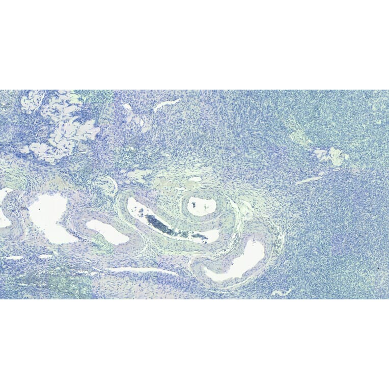 Immunohistochemistry - Anti-FOXL2 Antibody (A83945) - Antibodies.com