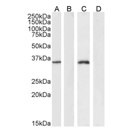 Western Blot - Anti-FOXL2 Antibody (A83945)