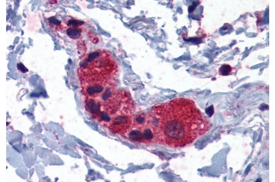 Immunohistochemistry - Anti-MYRIP Antibody (A83946) - Antibodies.com